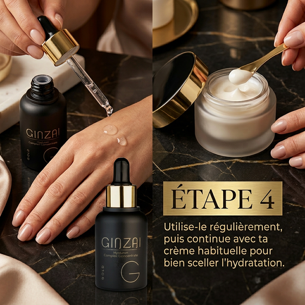 Étape 4